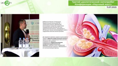 Байков Н.А. - Актуальные подходы к комбинированной терапии СНМП