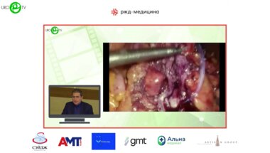 Кочкин А.Д. - Лапароскопическая хирургия коралловидного нефролитиаза