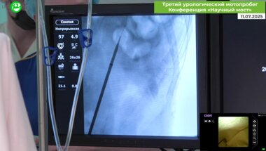 Байков Н.А. - Ретроградная интраренальная хирургия