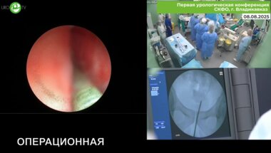 Маликиев И.Е., Горелов Д.С. - Ретроградная интраренальная хирургия HugeMed 7.5F