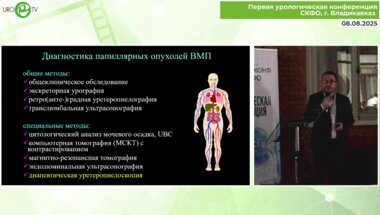 Дутов С.В. - Эндоскопическая диагностика и лечение папиллярных опухолей ВМП