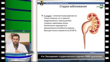 Сафаев Е.У. - Гидронефроз, нефроптоз, поликистоз почек