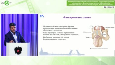 Топузов Т.М. - Хирургическая анатомия мужского таза. Пошаговая установка мужского репозиционного слинга
