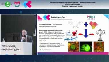 Гуспанов Р.И. - Перспективы применения технологии ICG в онкоурологии