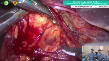 Санжаров А.Е.  - Лапароскопическая пластика пиелоуретерального сегмента