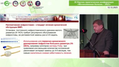 Малинин Ю.Ю. - Видеопрезентация перкутанной нефролитолапаксии