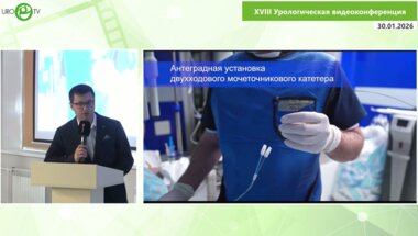 Абоян И.А. - Эндоскопическое лечение облитераций интрамурального отдела мочеточника. Методика Ранде-Ву