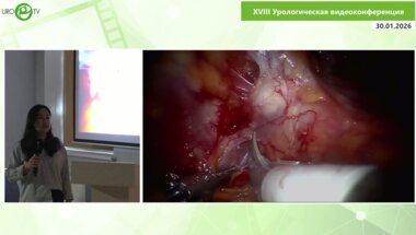 Бадмаева Е.М. - Робот-ассистированная простатэктомия у пациентов с выраженной средней долей