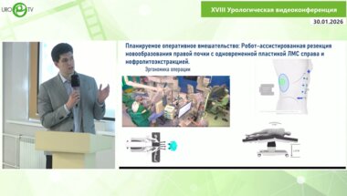 Гнеев Н.Ю. - Роботическая резекция почки с одновременной пластикой ЛМС и литоэкстракцией