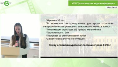 Гулиев Б.Г. - Аппендикулярная onlay-пластика мочеточника при рецидивной стриктуре: малоинвазивное устранение осложнений