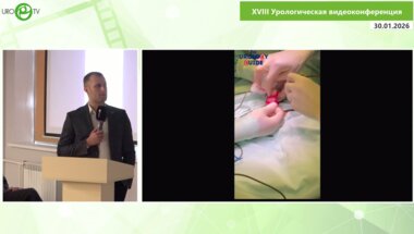 Ирицян М.М. - Графтинг белочной оболочки полового члена при Болезни Пейрони