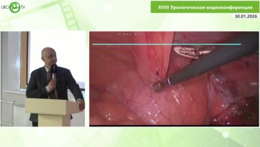 Шкодкин С.В. - Нейрогенная дисфункция мочевого пузыря и рецидивная стриктура левого мочеточника, лапароскопическая пластика