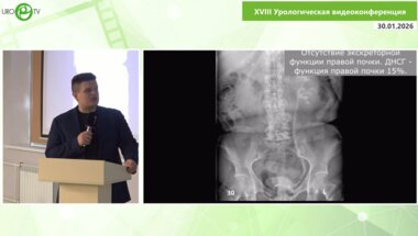 Трушкин Р.Н., Медведев П.Е., Исаев Т.К., Иванов К.В., Щеглов Н.Е.- Лапароскопический уретероцистоанастомоз (по Боари)