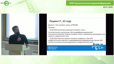 Тулинов М.А. - Робот-ассистированная пахово-бедренная лимфаденэктомия при раке полового члена