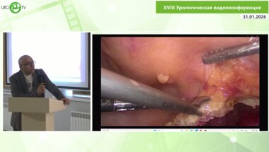 Бобоев М.М. - Лапароскопическая аденомэктомия в деталях