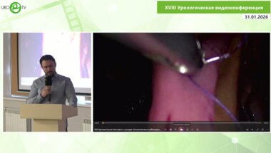 Ерохин О.А., Гизатулин И.Т., Габдрахманов Л.Д. - Аугментация мочевого пузыря - клиническое наблюдение