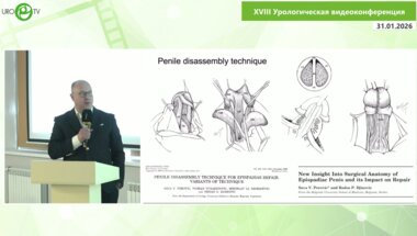 Красильников Д.Е. - Техника «разборки полового члена» при эписпадии