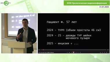 Мамаев И.Э. - YV пластика при СШМП. Без лапаротомии и без робота