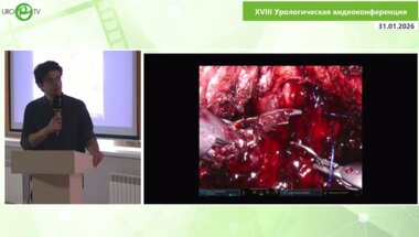 Маммаев Р.У. - Нетипичные случаи простатэктомии со сбережением пространства Ретциуса