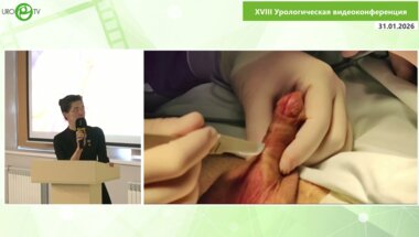 Манашерова Д.Т. - Осложнения в отдаленном периоде после уретропластики кожным лоскутом