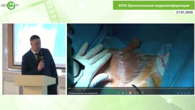 Пинчук И.С. - Пликация уретры при недержании мочи у мужчин