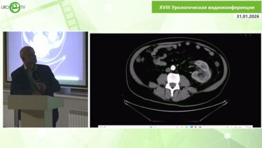 Сегедин Р.Е. - Редкий случай гигантской кавернозной гемангиомы левого надпочечника