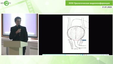Степанченко В.С. - Лапароскопическая пластика уретро-ректального свища после РПЭ