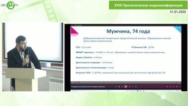 Черкасов А.А. - Симультанная лапароскопическая аденомэктомия и резекция мочеточника