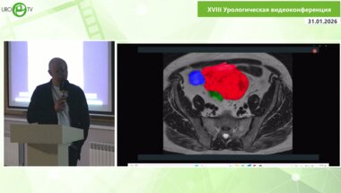 Шкодкин С.В. - Большая неэпителиальная опухоль мочевого пузыря или кишки