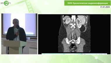 Шкодкин С.В. - Мочевой перитонит после ранения мочеточника