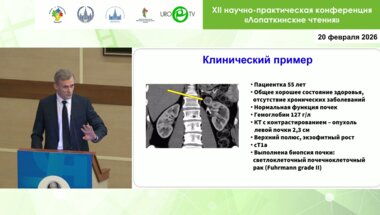 Говоров А.В. - Минимально инвазивные методы лечения рака почки – что мы знаем в 2026 году?