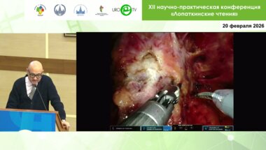 Пушкарь Д.Ю. - Робот-ассистированная радикальная простатэктомия – без единого клипа