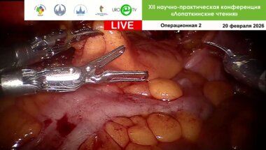 Робот-ассистированная простатэктомия. Модераторы Пушкарь Д.Ю., Галлямов Э.А., Шпоть Е.В. Оператор: Неизвестный мастер