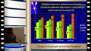 Криштопа М.В. - "Антеградная и ретроградная уретеролитотрипсия,екстракорпоральная ударно - волновая литотрипсия, лапароскопическая уретеролитотомия в лечении камней проксимального отдела мочеточника"