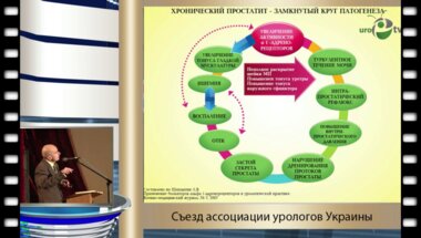 Баныра О.В. - "Использование селективных альфа 1-адреноблокаторов в лечении пациентов с хроническим простатитом"