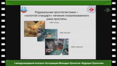 Абдуллин И.И. - "Лапароскопическая радикальная простатэктомия, опыт первых 100 операций"