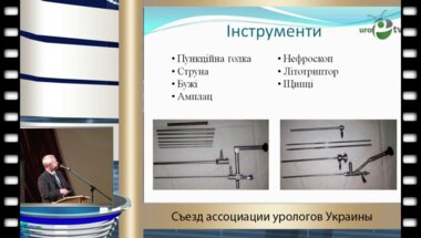 Журавчак А.З. - "Миничерезкожкая нефролитотрипсия в лечени камней почек анализ первого опыта"