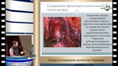 Фролов А.С. - "Континентная радикальная простатэктомия"