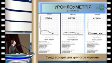 Шмуличенко О.В. - "Критерии обратимости патофункциональных изменений мочевого пузыря после хирургического лечения по причине ДГПЖ"