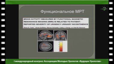 Касян Г.Р. - "Гиперактивный мочевой пузырь"