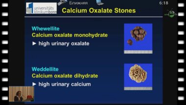 Siener R. - "Патогенетическая информация из анализа камней"