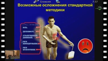 Насиров Ф.Р. - "Бездренажная ПКНЛТ – опыт нашей клиники"