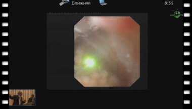 Geavlete P. - "Видео fURS"