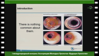Осама Т. Абдулдахаб - "Применение металических стентов в урологии"