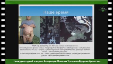 Холтобин Д. - "Цистопластика у больных туберкулезом мочевого пузыря"