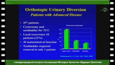 Джаван Б. - "Ортотопический метод отведения мочи при цистэктомии"