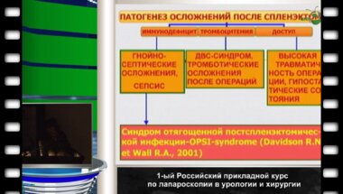 Тимербулатов М.В. - Лапароскопические операции в хирургии селезенки