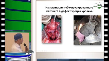 Бутнар Д.В. - "Заместительная уретропластика с использованием ткане - инженерной конструкции на основе децеллюлязированной трупной артерии и аутологичных эпителиоцитов щеки (оперативная техника - Asopa)"