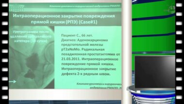 Богданов А.Б. - "Диагностика и лечение уретро - прямокишечных свищей"