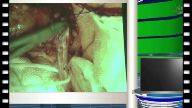 Серегин А.В. - "Бактериальный синхронный уротелиальный рак верхних мочевых путей"